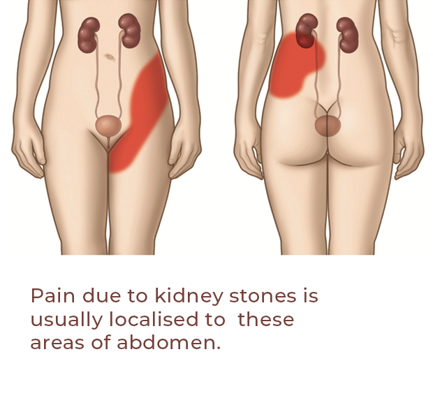 pain-due-to-kidney